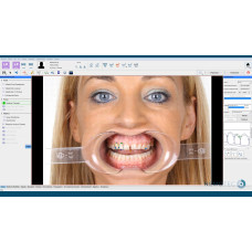 NemoSmile Design 2D NemoSmile Design 2D