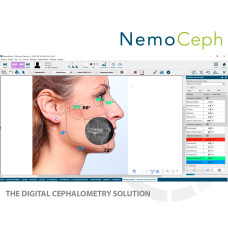 NemoCeph NemoCeph
